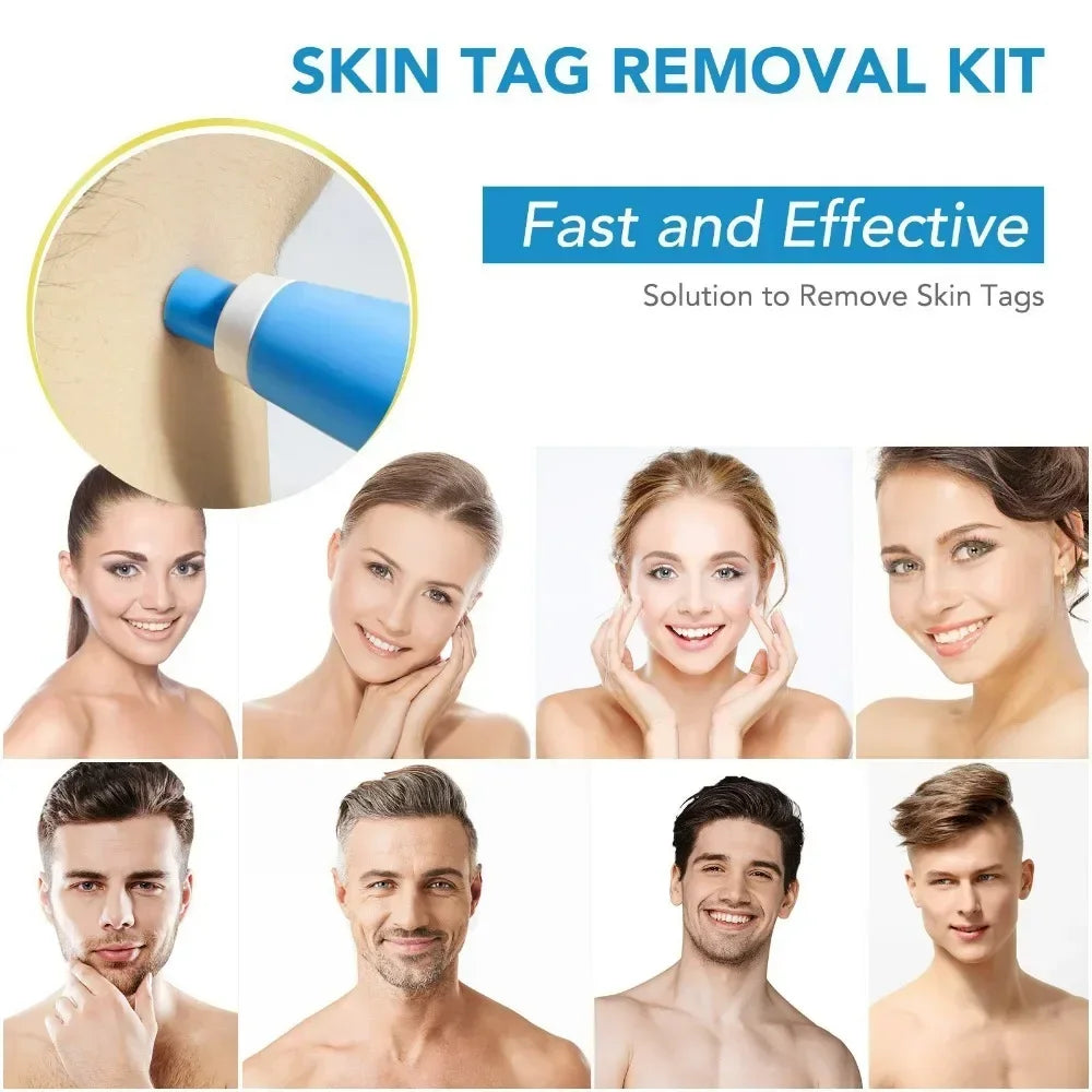 2-In-1 Painless Auto Skin Tag Mole Wart Removal Kit