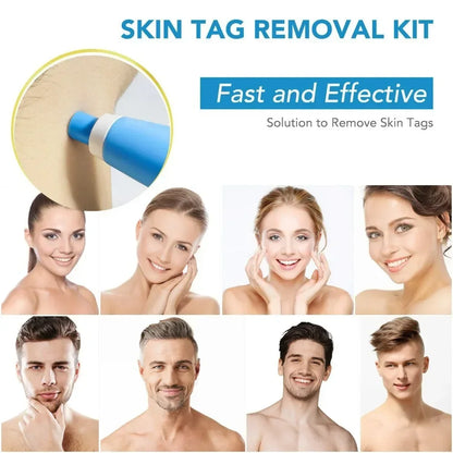 2-In-1 Painless Auto Skin Tag Mole Wart Removal Kit
